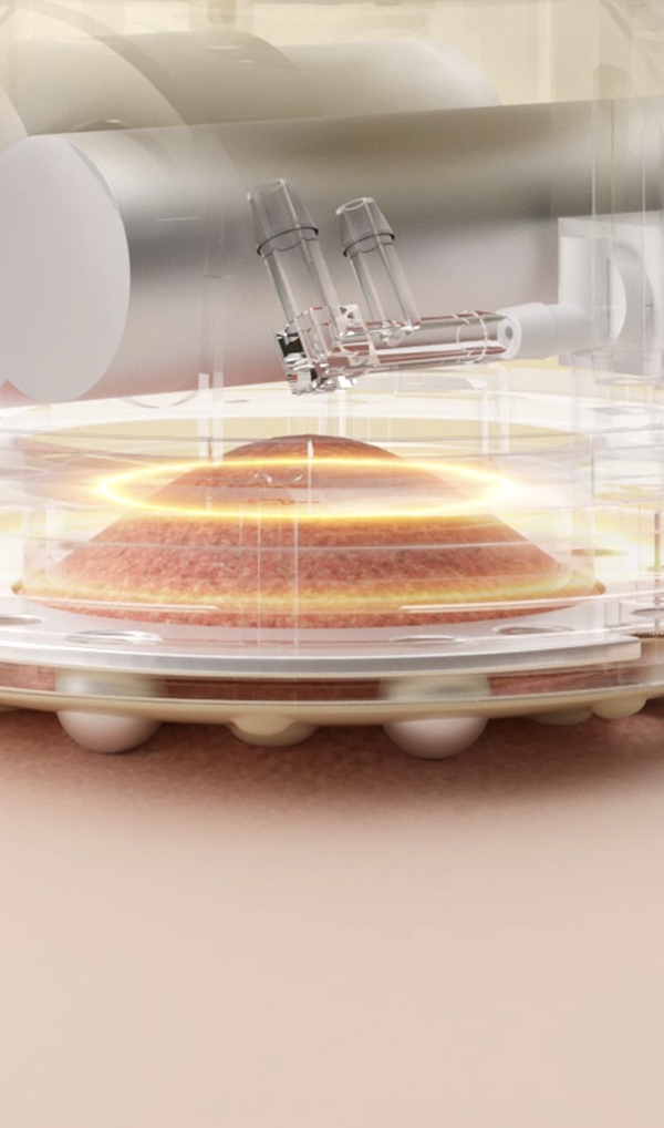 GravityPress<br>引力负压技术